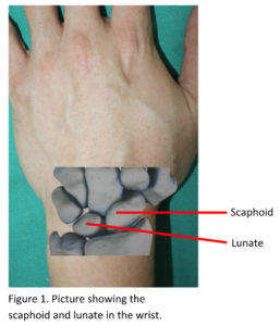 scaphoid lunate in the wrist